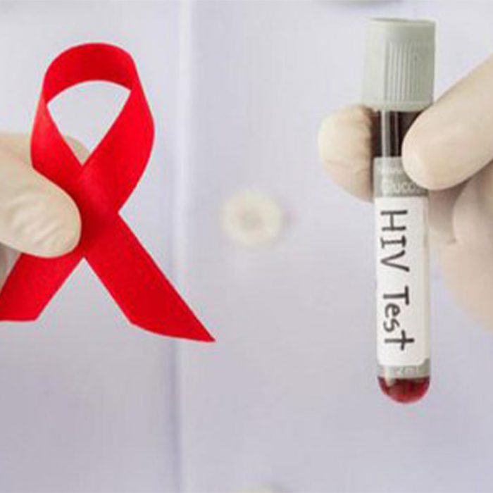 Dự phòng trước phơi nhiễm HIV (PrEP) và những điều cần biết