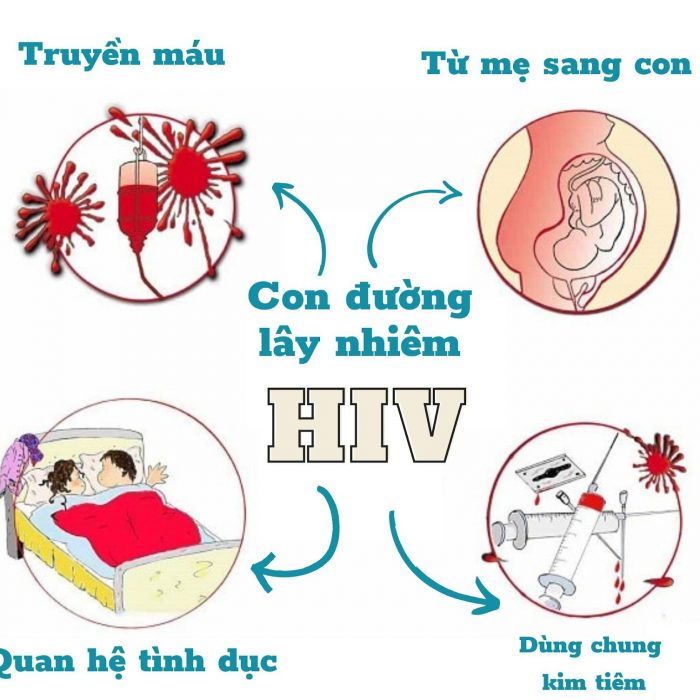 Phương thức lây nhiễm HIV và  các biện pháp phòng ngừa HIV