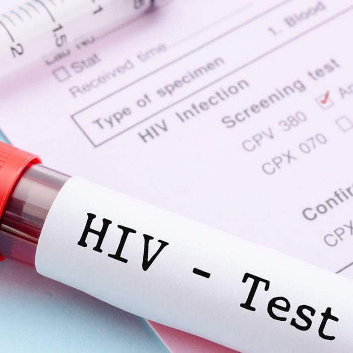 Xét nghiệm chẩn đoán HIV: thời điểm nào tốt nhất?