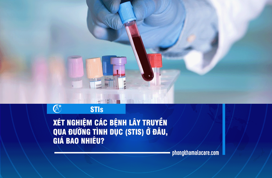 Xet-nghiem-cac-benh-lay-truyen-qua-duong-tinh-duc-STIs